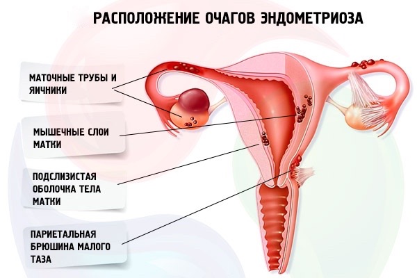 Каким должен быть эндометрий в день переноса
