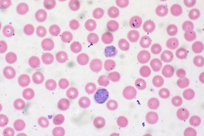 Диагностика малярии: мазок крови